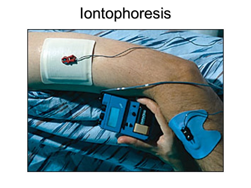 Iontophoresis Iontophoresis